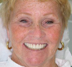 Close up of woman in Juno Beach showing imperfect teeth