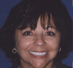 Close up of woman in Juno Beach showing imperfect teeth