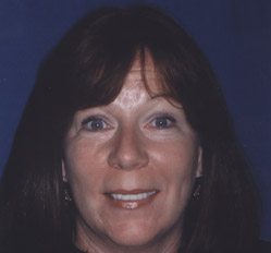 Close up of woman in Juno Beach showing imperfect teeth