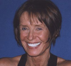 Close up of woman in Juno Beach showing imperfect teeth