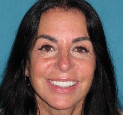 Close up of woman in Juno Beach showing imperfect teeth