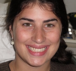 person in Juno Beach showing off smile makeover