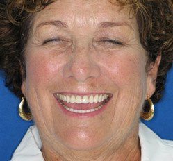 person in Juno Beach showing imperfect teeth