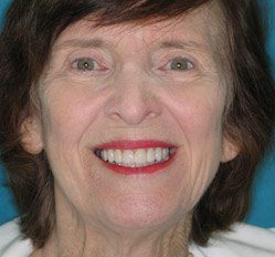 Close up of woman in Juno Beach showing imperfect teeth
