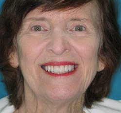 Close up of woman in Juno Beach showing imperfect teeth