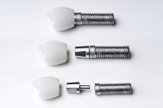 Dental implants near The Bluffs in Jupiter