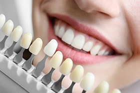 A young woman choosing the color of her teeth with a dentist