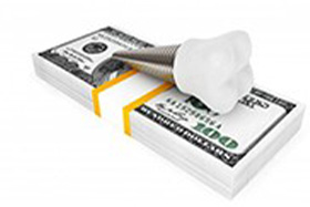 Illustration of a dental implant resting on a stack of dollar bills