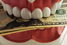 Model of a denture with dollar bills clenched in the teeth