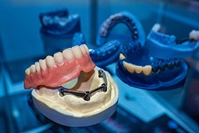 implant dentures in Juno Beach