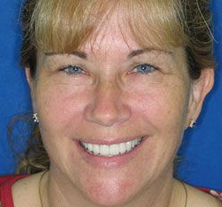 Barb after dental treatment