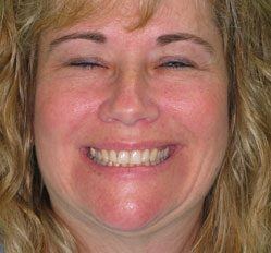 Barb before dental treatment