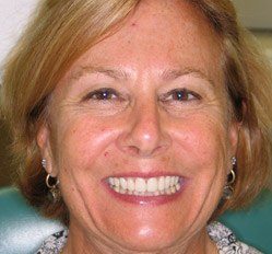 Claudia after dental treatment