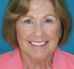 Pat after dental treatment