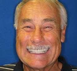 Ron after dental treatment