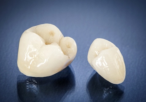 Two porcelain crowns of different sizes against dark background