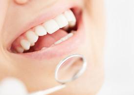 A closeup of a smiling patient’s mouth.