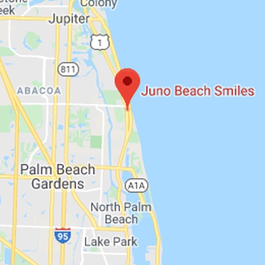 map of office location relative to Palm Beach Gardens