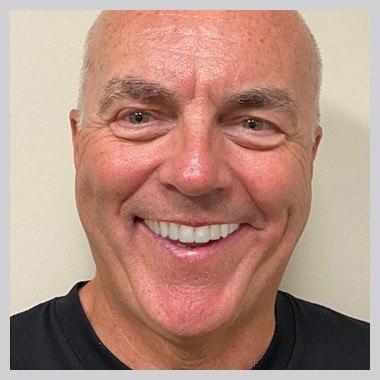 Juno Beach man smiling after smile makeover