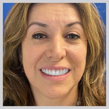 Woman in Juno Beach showing off smile makeover