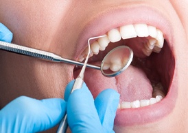 Patient getting a dental checkup in Juno Beach