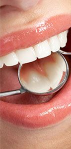 Closeup of healthy smile