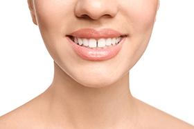 SureSmile can close gaps between teeth