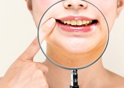 A young woman holding a magnifying glass up to her mouth and pointing to her stained teeth