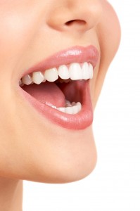 Porcelain veneers