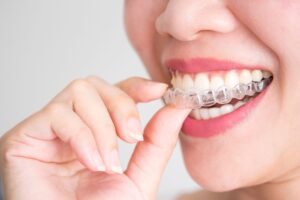 view of the bottom half of a woman's face with her thumb and forefinger removing an Invisalign tray