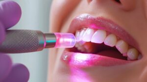 Closeup of a woman's smile being shaped with laser